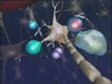 Patogenia de la Esclerosis Multiple