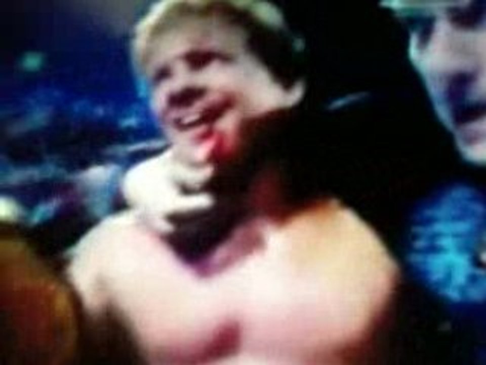Y2J dent casser no mercy 08