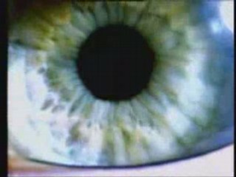 Fish - Hold Your Head Up