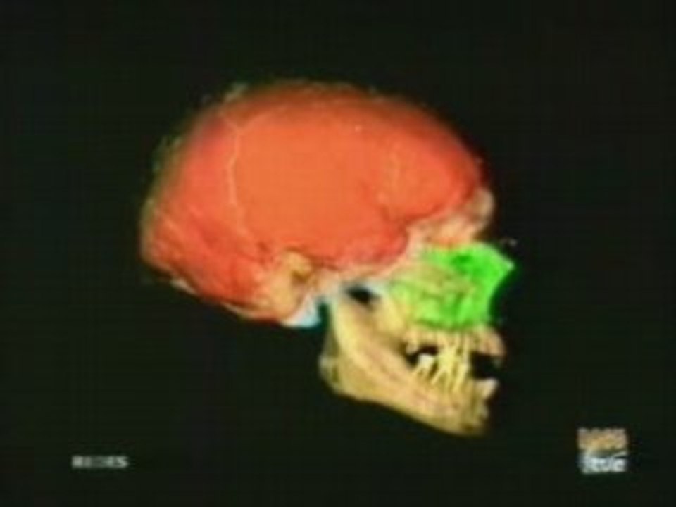 Cerebro humano: Evolucion