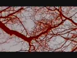 Berurier noir - La pluie