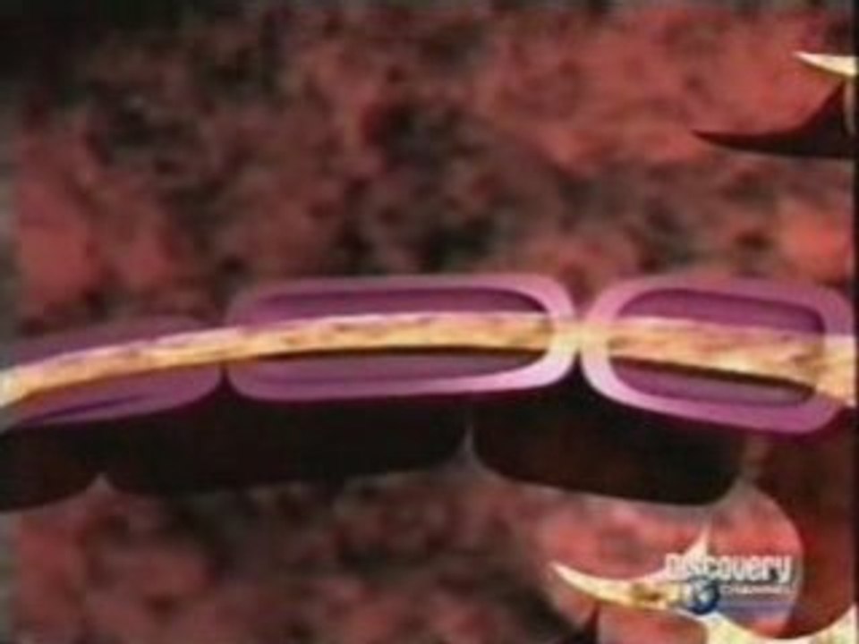 Daño axonal difuso (TCE)