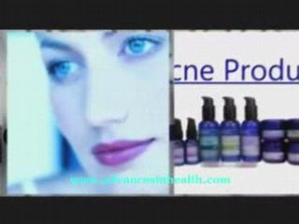 what you should know about acne medicine products