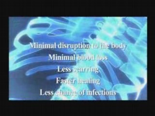 Lumbar spine pain from Bonati