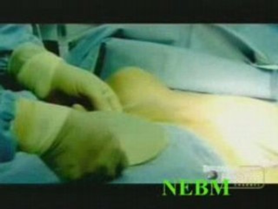 Cathy Berry Implant Surgery