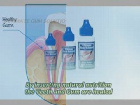 receding gums,gum surgery,gum disease,gum recession