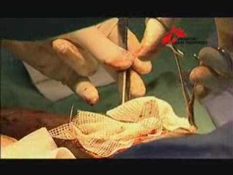 RDC - Situation humanitaire critique au Nord Kivu