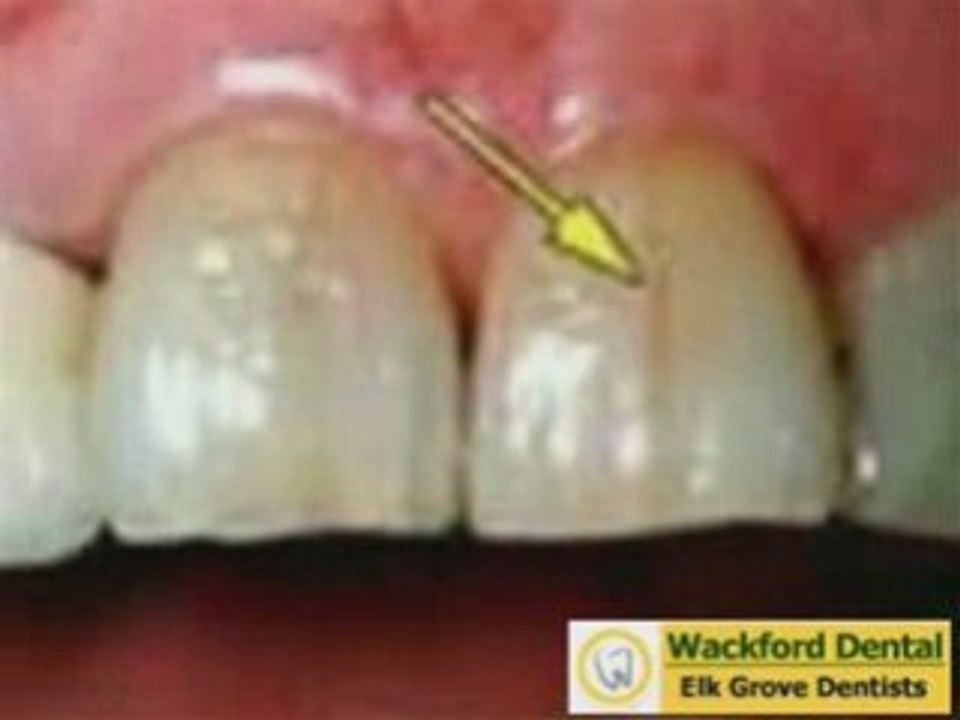 Elk Grove dentists - Dental advice Sacramento county