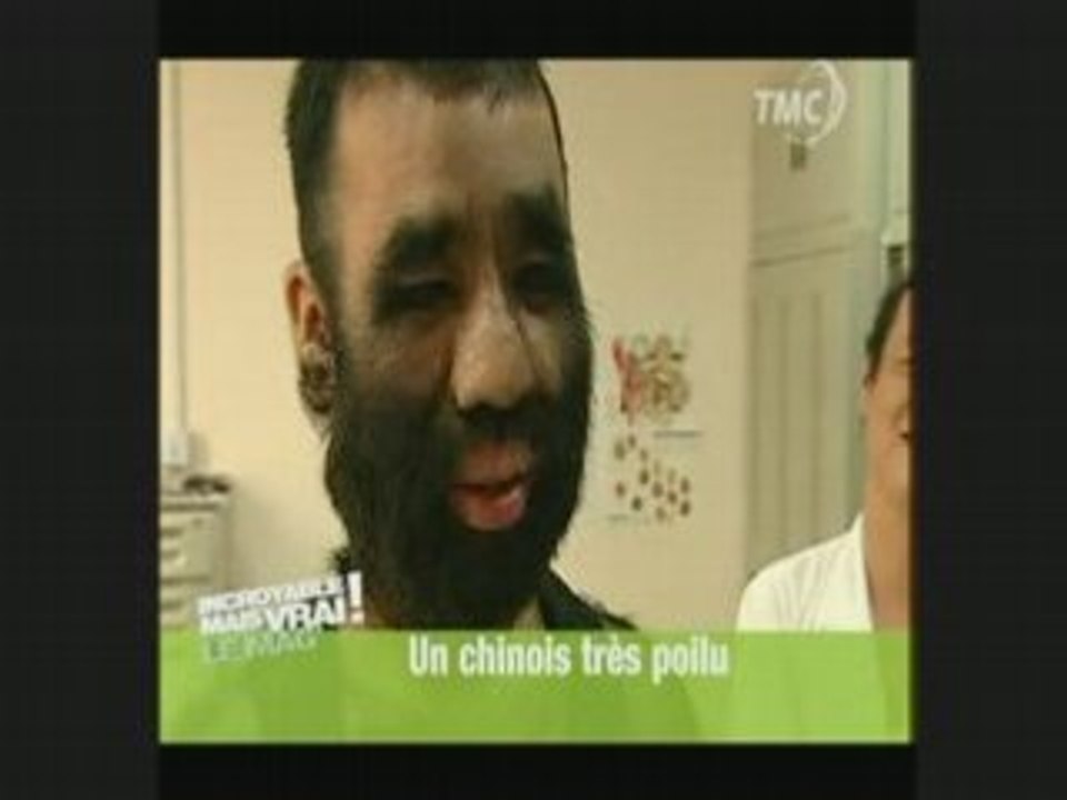 l'homme le plus poilu : un chinois
