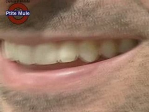 Des prothèses dentaires à risque