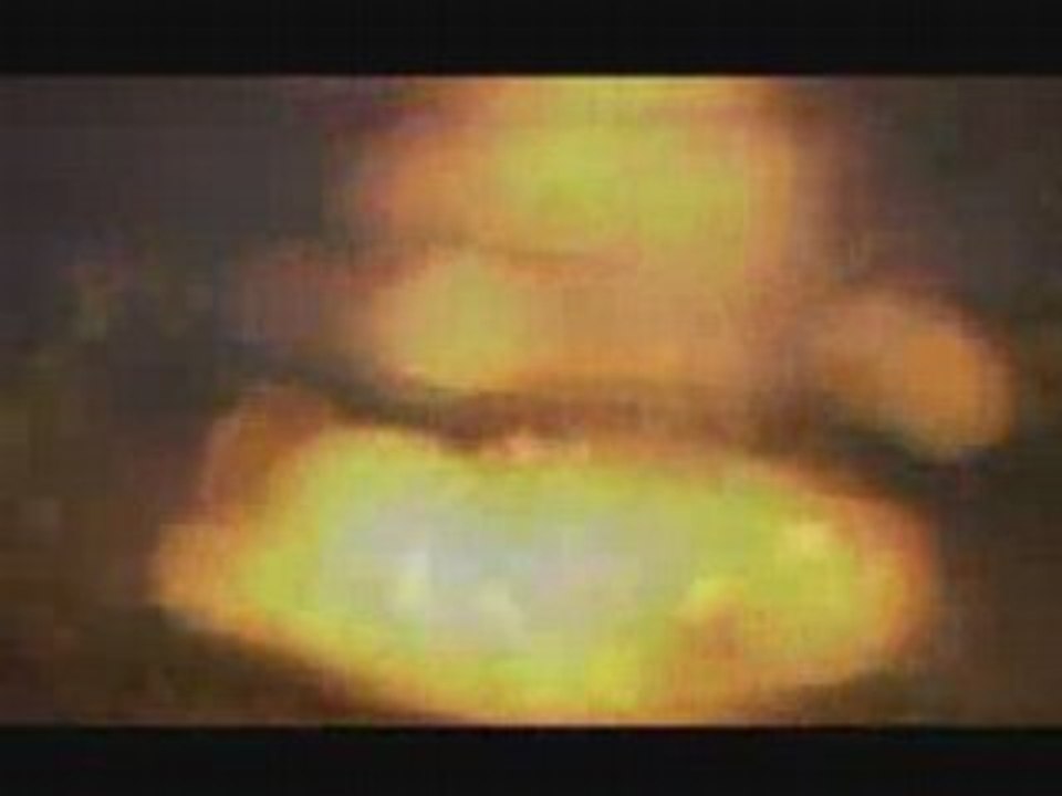 Video on Health and Healing
