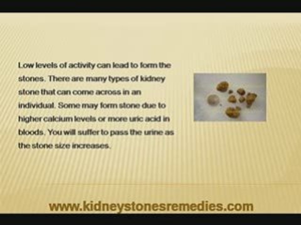 Kidney Stones Remedies