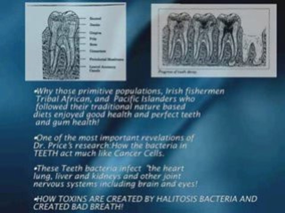 how to get rid of bad breath,bad breath help in Los Angeles
