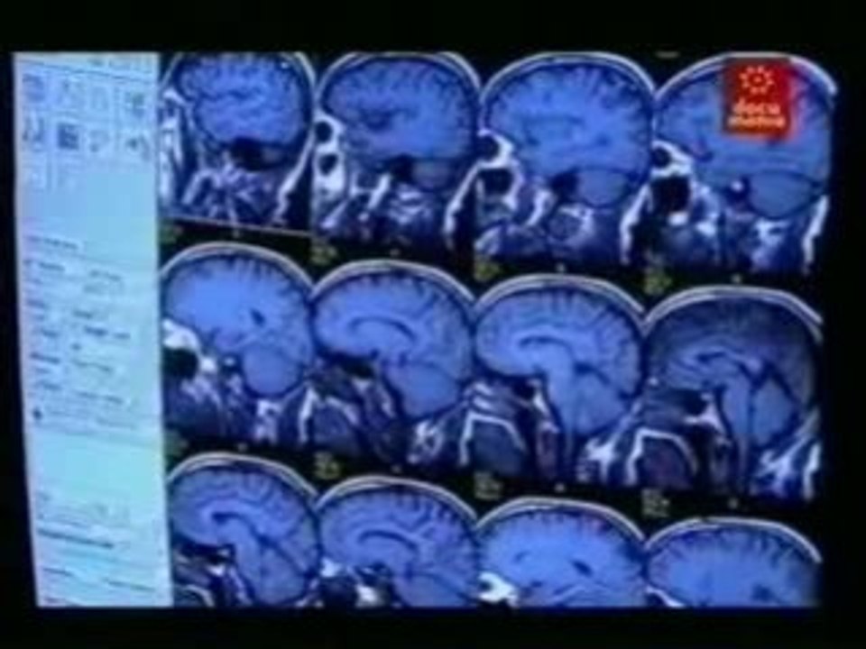 Cerebro humano: Avances