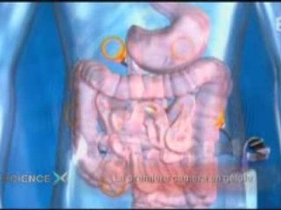 la gelule camera  -Science X - (HT medcine )  [les Bogdanov]