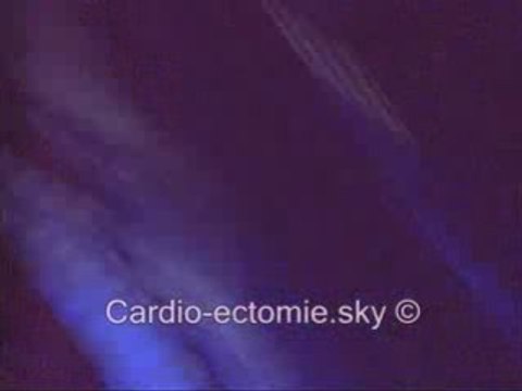 Untitled - Simple Plan Lille