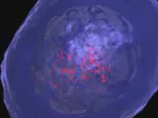 Apoptosis