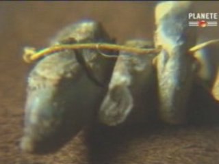 Les découvertes de l'Antiquité - la chirurgie #2