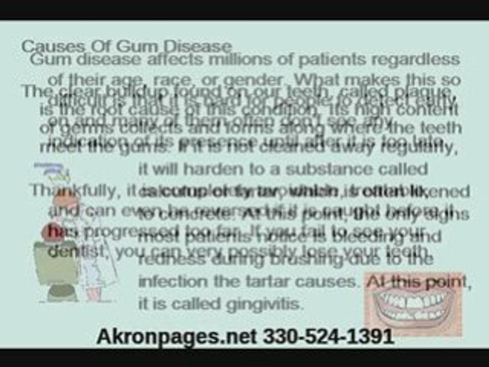 Akron, Oh What is Gum Disease?