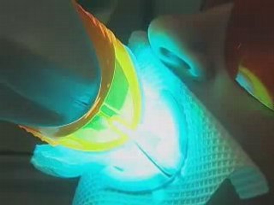 Teeth Whitening