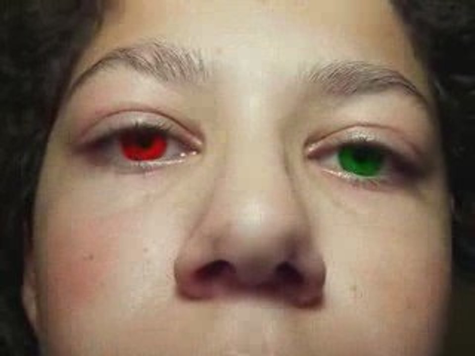 Changement de couleur des yeux