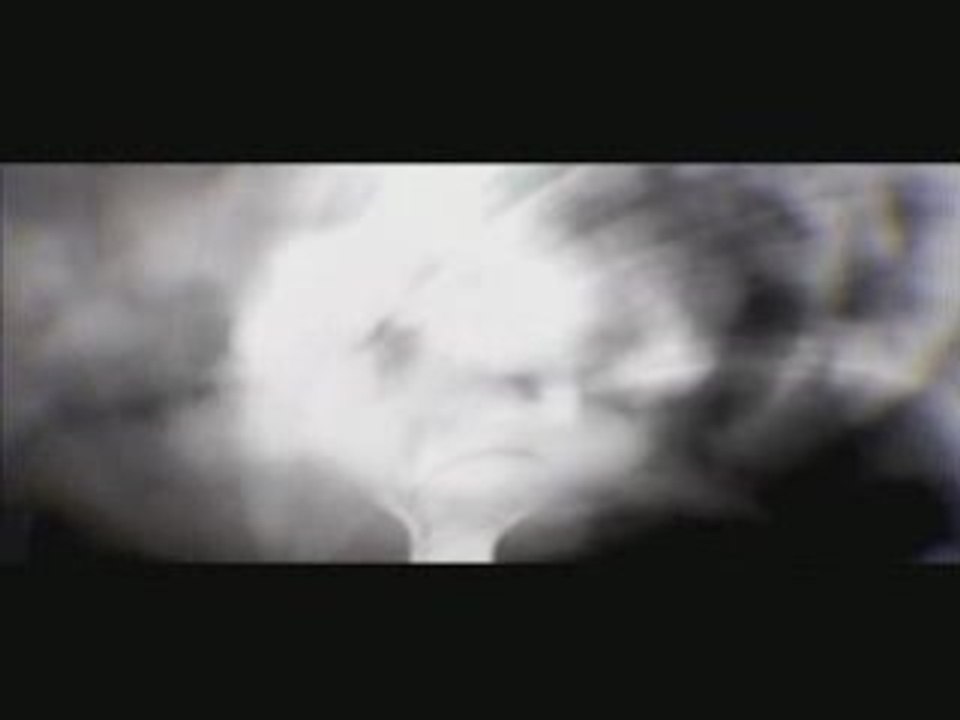 Venetian Snares - Szamar Madar