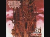 Timeline Medley #5: Cannibal Corpse