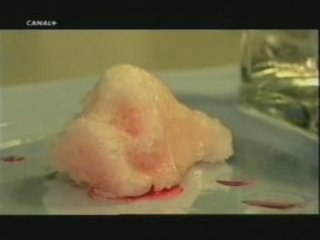 Ingenieria de tejidos: Creacion de narices