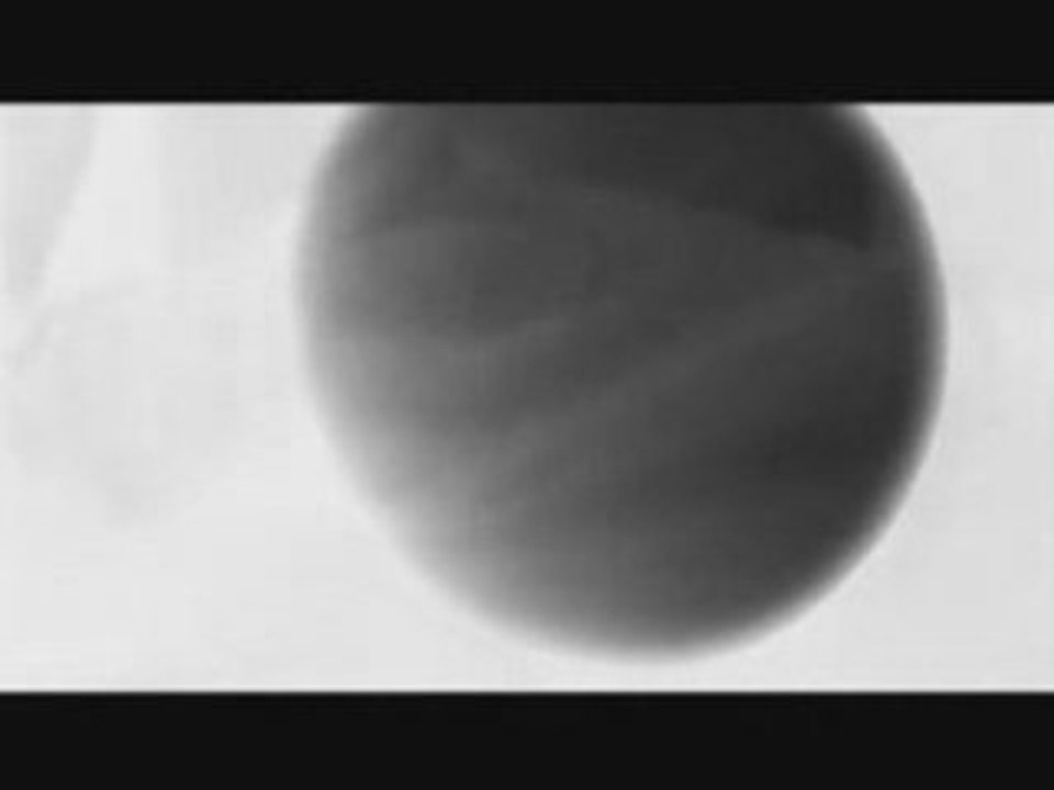 DIR EN GREY - GLASS SKIN 「english」