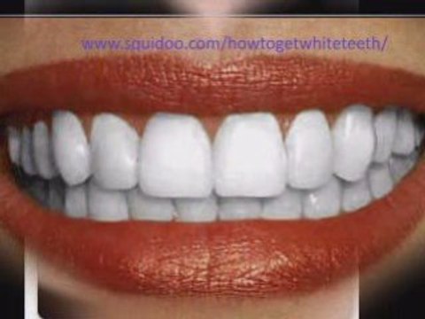 Teeth whitening, how to get white teeth ,natural white teeth