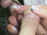 Pose d'ongles en Acrylique sur Tips Blancs