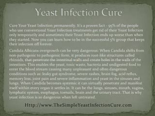Natural Yeast Infection Treatment