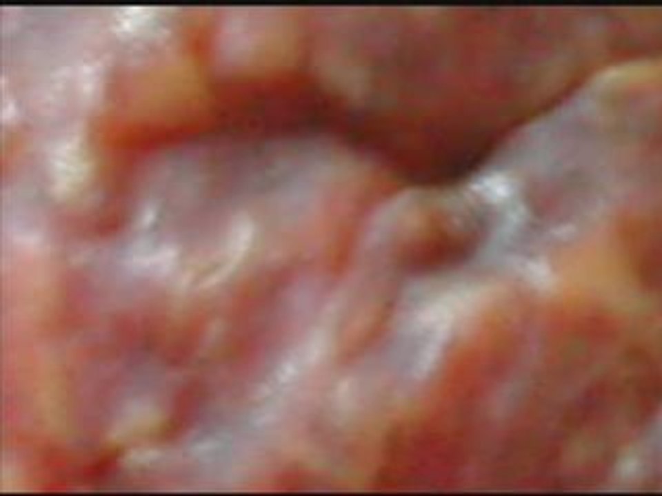 projet tanindrazana Ectoplasme