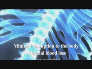 Cervical spine surgery