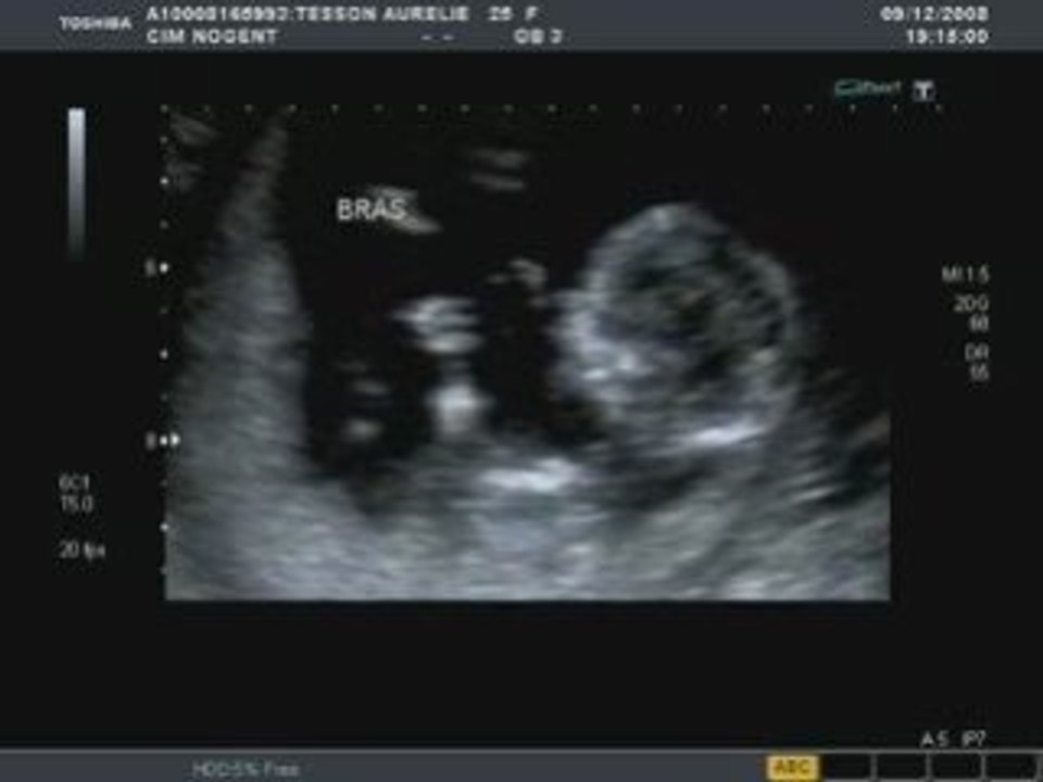 Video2