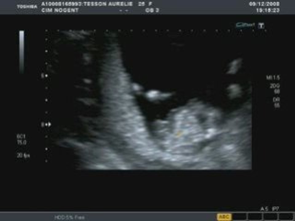 Video3
