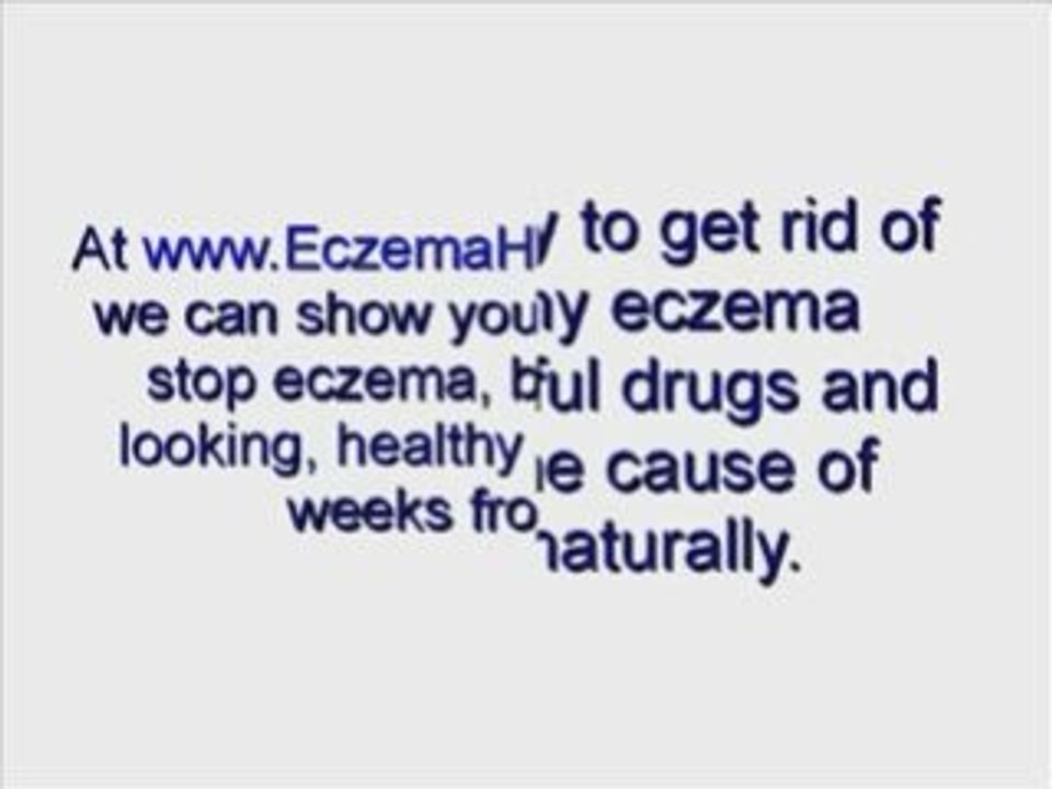 Treatments for eczema - holistic ways to cure painful eczema