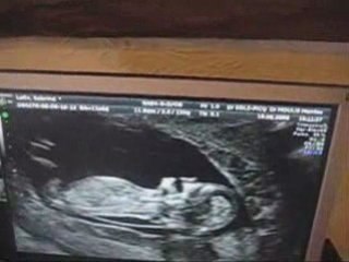 grossesse pour ma fille clara