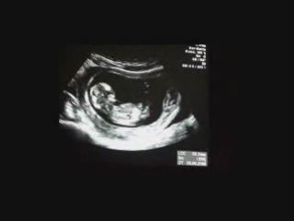 BabyProject
