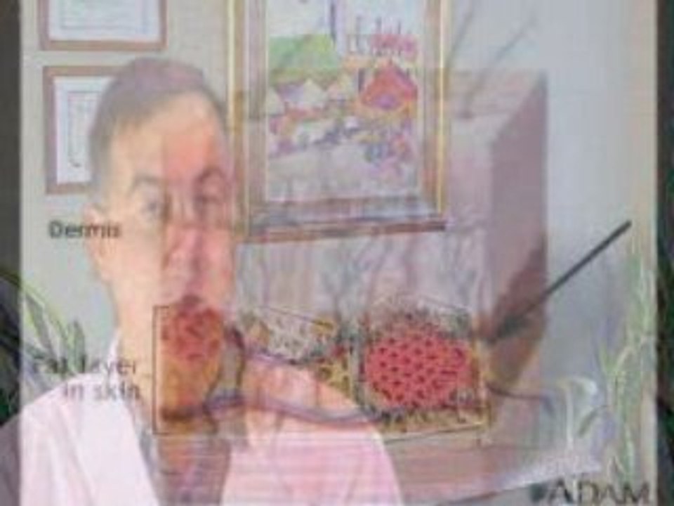 Soft Tissue Fillers For Facial Rejuvenation