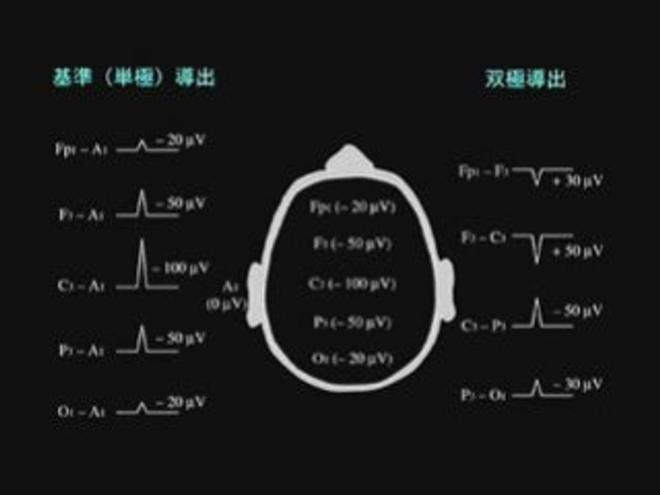 EEG in Japanese