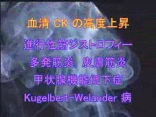 peripheral neuropathy in Japanese