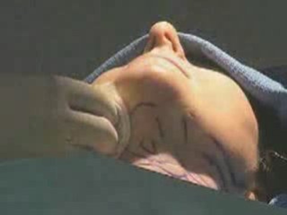 Actual Neck Procedure