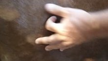 intraarticular / hombro