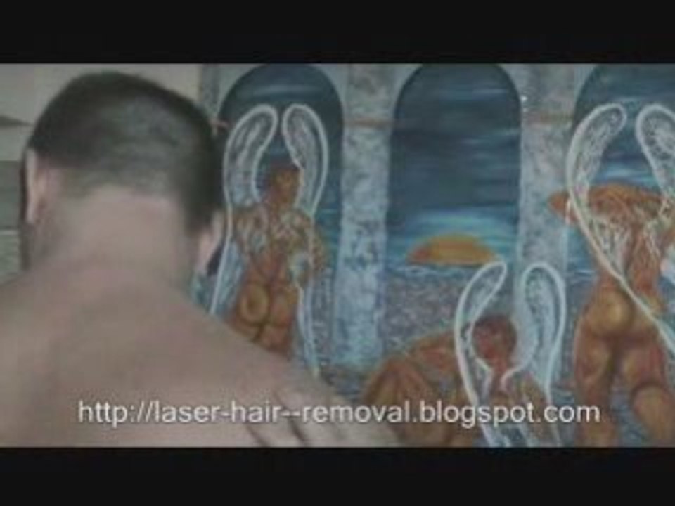 Back Laser hair Removal