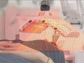 Photo Skin Regeneration Brisbane