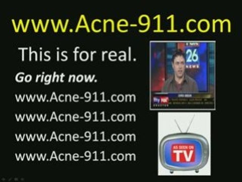 How to Get Rid of Pimples Acne-inc