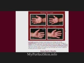 How To Treat Rough Skin Using Glimpse Intuitive Skin Care