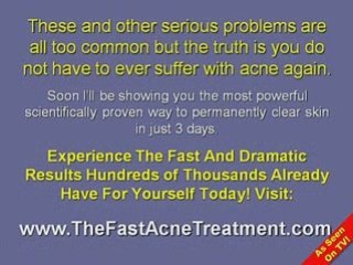 The Five Secrets to Clearing Your Skin to Get Rid of Acne