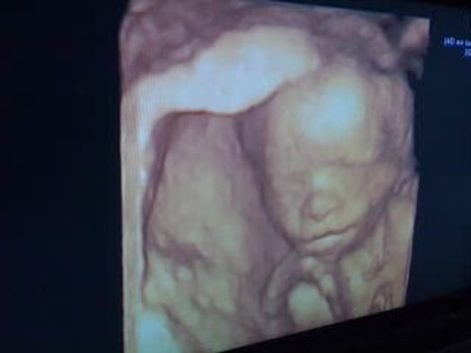 Echo 3D Montibouchon